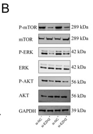 Phospho-AKT1/2/3 (Ser473) Antibody - Figure 6 EZH2 may have functions in the AKT/ERK-mTOR pathways: (A) The relative abundance of PI3K, AKT1, AKT2, AKT3, and mTOR in PCs when there was EZH2 gene silencing.