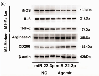 ARG1 Antibody - Figure 3.