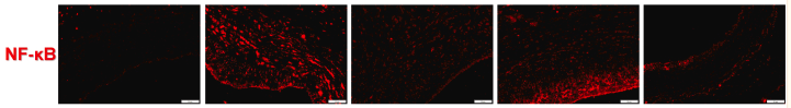 NF-kB p65 Antibody - Fig.