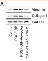 Collagen I Antibody - Figure 6 Overexpression of SPINT2 prevents PDGF-BB-induced SMC phenotypic switching.