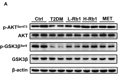 Phospho-GSK3 beta (Ser9) Antibody - Figure 2 Rb1 treatment enhances hepatic glycogen production by regulating the AKT/GSK3β signaling pathway in T2DM mice.