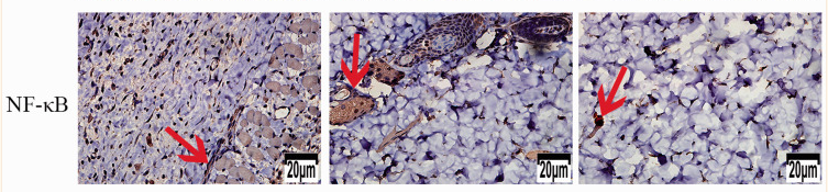 NF-kB p65 Antibody - Figure 10.