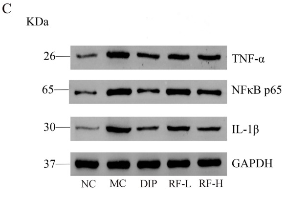 NF-kB p65 Antibody - Fig.