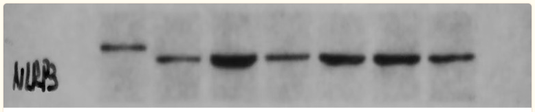 NLRP3 Antibody - Figure 1 Expression of NLRP3, Caspase-1, and GSDMD in the decidua of pregnant rats in each group.
