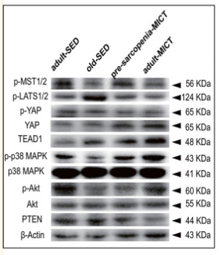 Phospho-AKT1/2/3 (Ser473) Antibody - FIGURE 3 Altered mRNA expression of downstream target genes enriched in KEGG pathways, and expression of HIPPO, MAPK, and PI3K/Akt in each study group.