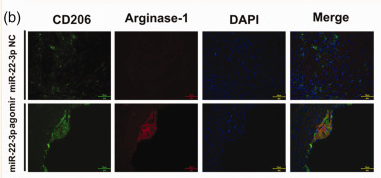 ARG1 Antibody - Figure 3.