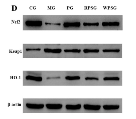beta Actin Antibody - Fig.