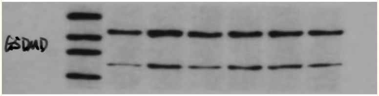 GSDMD Antibody - Figure 1 Expression of NLRP3, Caspase-1, and GSDMD in the decidua of pregnant rats in each group.
