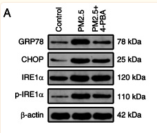 Phospho-IRE1 (Ser724) Antibody - Figure 2 Expression of endoplasmic reticulum stress-related proteins in HBE135-E6E7 cells.