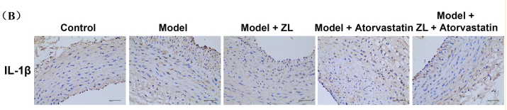 IL1 beta Antibody - Fig.