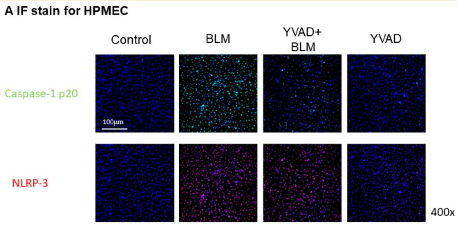 Cleaved-Caspase 1 (Asp296), p20 Antibody - Figure 5 Inhibition of NLRP3 inflammasome reduced BLM-induced EndoMT in vitro.