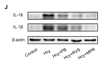 IL1 beta Antibody - Fig.