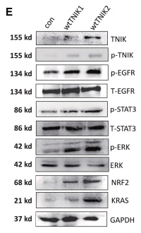 STAT3 Antibody - Figure 4 TNIK binds to the ECD domain to phosphorylate EGFR and regulate ferroptosis resistance (A) Immunoprecipitation of TNIK in C4-2 cells followed by immunoblot analysis of EGFR or TNIK.