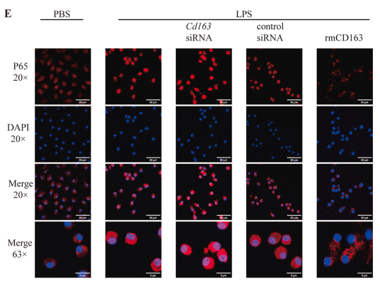 NF-kB p65 Antibody - Fig.