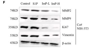 MMP9 Antibody - Figure 5 ImP played a role in regulating wound healing by inhibiting the downstream Rho pathway of S1P (A and B) Functions and pathways negatively enriched for ImP treated cells and positively enriched for S1P treated cells were shown.