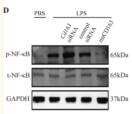 NF-kB p65 Antibody - Fig.