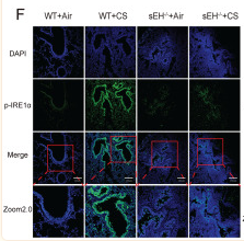 Phospho-IRE1 (Ser724) Antibody - Fig.