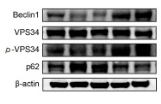 Beclin 1 Antibody - Fig.