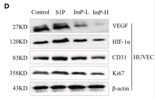 HIF1A Antibody - Figure 5 ImP played a role in regulating wound healing by inhibiting the downstream Rho pathway of S1P (A and B) Functions and pathways negatively enriched for ImP treated cells and positively enriched for S1P treated cells were shown.