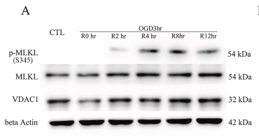 beta Actin Antibody - Fig.