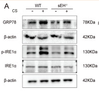Phospho-IRE1 (Ser724) Antibody - Fig.