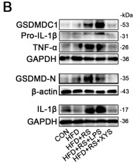 GSDMD Antibody - Figure 2 Effect of restraint stress on NLRP3 signaling in hepatosteatotic mice The expressions of hepatic NLRP3, ASC, Pro-Caspase-1, Caspase-1 (A), GSDMDC1, GSDMD-N, Pro-IL-1β, IL-1β, and TNF-α (B) was determined by western blot analysis (n=3).
