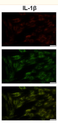 IL1 beta Antibody - FIGURE 6 Effect of AB4 treatment on the mitochondrial membrane potential, mitochondrial lipid peroxide and cellular ROS in C6 cells.