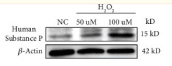 beta-Actin Antibody - Figure 3 ROS significantly induced the expression of substance P.