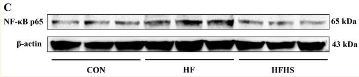 NF-kB p65 Antibody - Figure 7 Effects of adding sanguinarine to a high-fat diet on NF-κB gene expression and protein expression of grass carp.