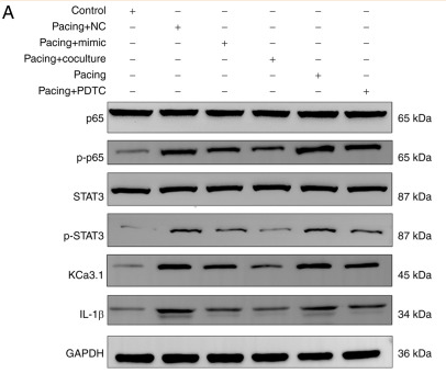 IL1 beta Antibody - Figure 5.