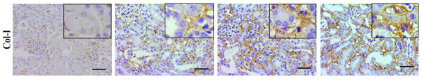 Collagen I Antibody - Figure 2 The expression of Anp32e protein was upregulated and positively correlated with fibrosis-related proteins in UUO mice.