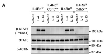 beta Actin Antibody - Figure 4Inhibition of STAT6 phosphorylation abolishes IL-4/IL-13-induced angiogenic response in ECs.