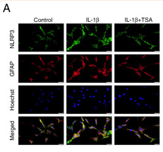 IL1 beta Antibody - Figure 6 Effect of TSA on HDAC6 and NLRP3 expression in C6 and U-87 MG cells.