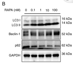 SQSTM1/p62 Antibody - Figure 4.