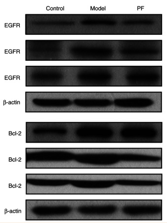 EGFR Antibody - Figure 8 PF downregulated the protein expression levels of p-AKT1/AKT1, Bcl-2, EGFR, p-mTOR/mTOR, and p-PI3K/PI3K in the colonic mucosa from the dextran sodium sulfate-induced mice.