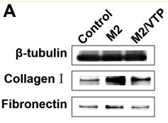 Collagen I Antibody - Figure 7.