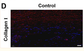 Collagen I Antibody - Figure 2.