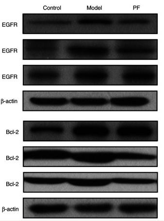 Bcl-2 Antibody - Figure 8 PF downregulated the protein expression levels of p-AKT1/AKT1, Bcl-2, EGFR, p-mTOR/mTOR, and p-PI3K/PI3K in the colonic mucosa from the dextran sodium sulfate-induced mice.