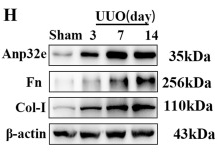 Collagen I Antibody - Figure 2 The expression of Anp32e protein was upregulated and positively correlated with fibrosis-related proteins in UUO mice.