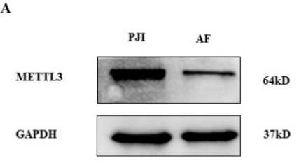 GAPDH Antibody - Figure 2 The expression of METTL3 in PJI and AF detected by Western blot (A) and statistical analysis (B).