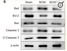 beta Actin Antibody - Fig.