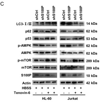 AMPK alpha Antibody - Figure 5 p53/AMPK/mTOR pathway was required for S100P-mediated autophagy regulating chemosensitivity.