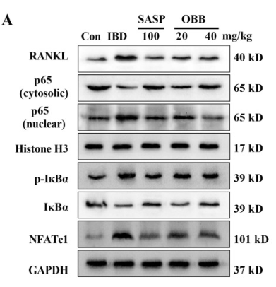 NF-kB p65 Antibody - Fig.