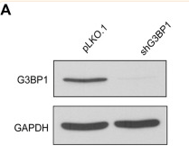 GAPDH Antibody - FIGURE 2 G3BP1 regulates the proliferation and invasion of breast cancer cells (A) Expression of G3BP1 in MDA-MB-231 stable knockdown cell line was analyzed by western blot [pLKO.
