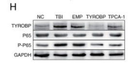 NF-kB p65 Antibody - Figure 9.
