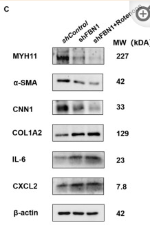 Collagen I Antibody - Figure 4 The double-hit effect of mitochondria and FBN1 dysfunction on the phenotypic transformation of SMCs.