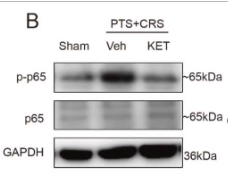 NF-kB p65 Antibody - Fig.