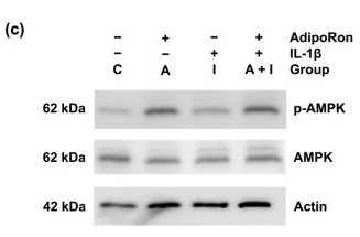 AMPK alpha Antibody - Figure 4 Effects of AdipoRon on p65 and adenosine monophosphate-activated protein kinase (AMPK) phosphorylation under proinflammatory conditions.