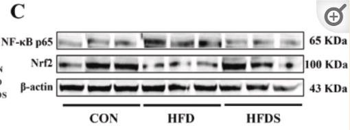 NF-kB p65 Antibody - Fig.
