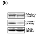 beta Actin Antibody - Figure 7 Effect of cerulein-induced chronic pancreatitis on intestinal barrier integrity.